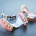 Types of Removable Dentures: A Complete Guide