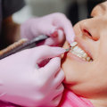 Understanding Oral Hygiene Practices After Surgery