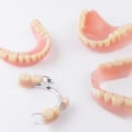 Pros and Cons of Removable Dentures: A Comprehensive Guide