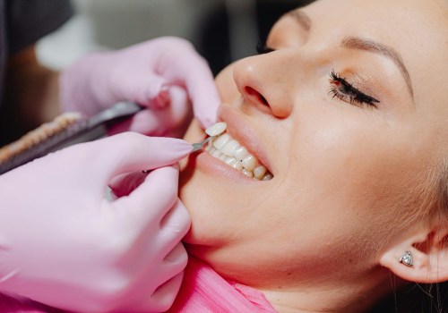 Understanding Oral Hygiene Practices After Surgery